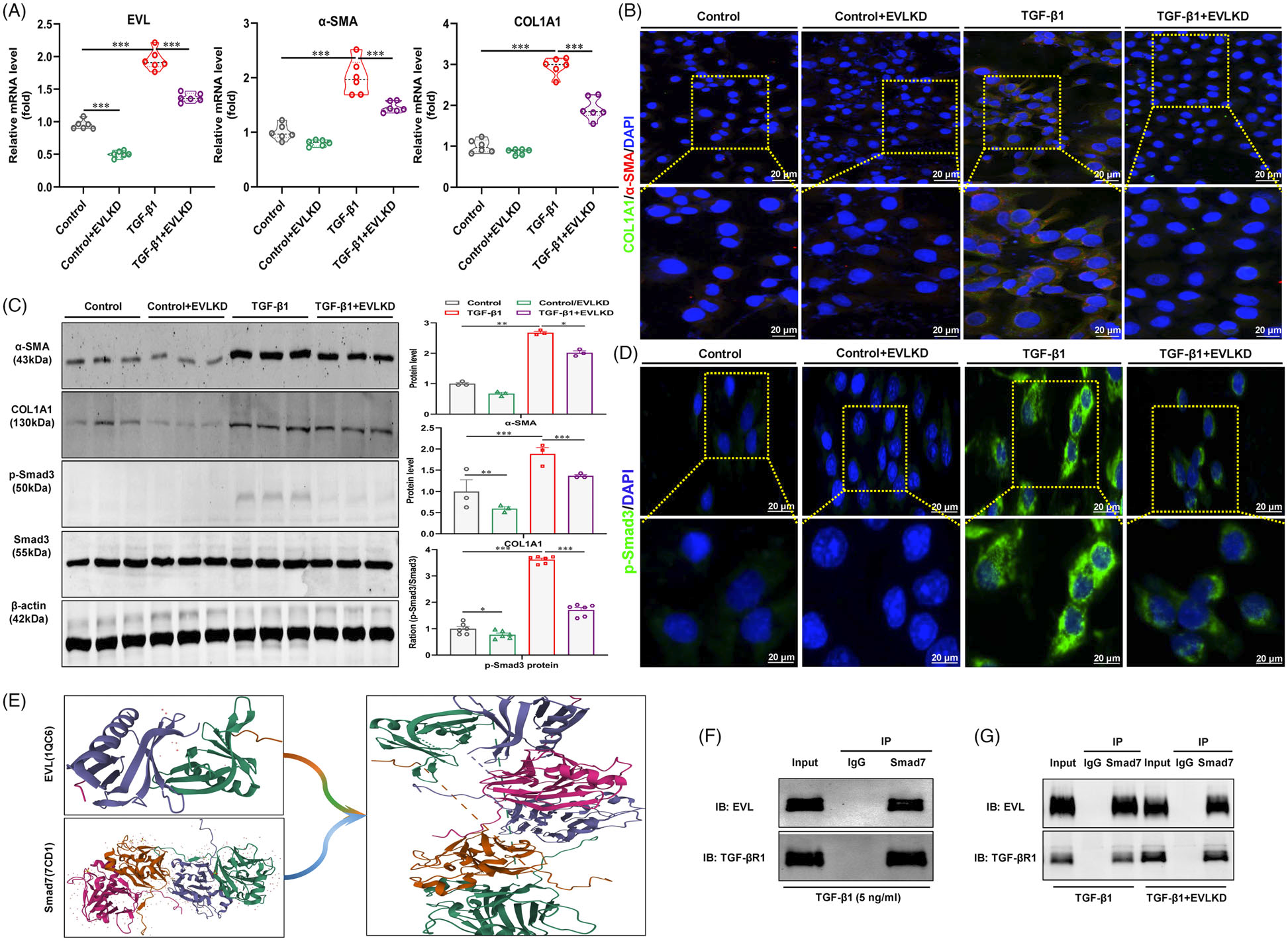 基因和药物抑制METTL3减少肾纤维化的表观遗传多组学机制研究