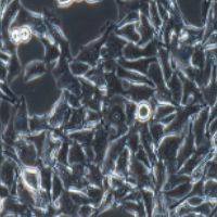 B16 小鼠黑色素瘤细胞