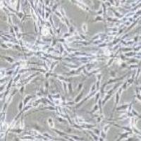 PC-12高分化 大鼠肾上腺嗜铬细胞瘤细胞 高分化