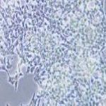 INS-1 大鼠胰岛细胞瘤细胞
