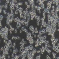 MFC 小鼠前胃癌细胞