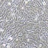 MEF 小鼠胚胎成纤维细胞 (丝裂/霉素C处理)