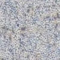 Sp2/O 小鼠骨髓瘤细胞