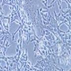 P19 小鼠畸胎瘤细胞