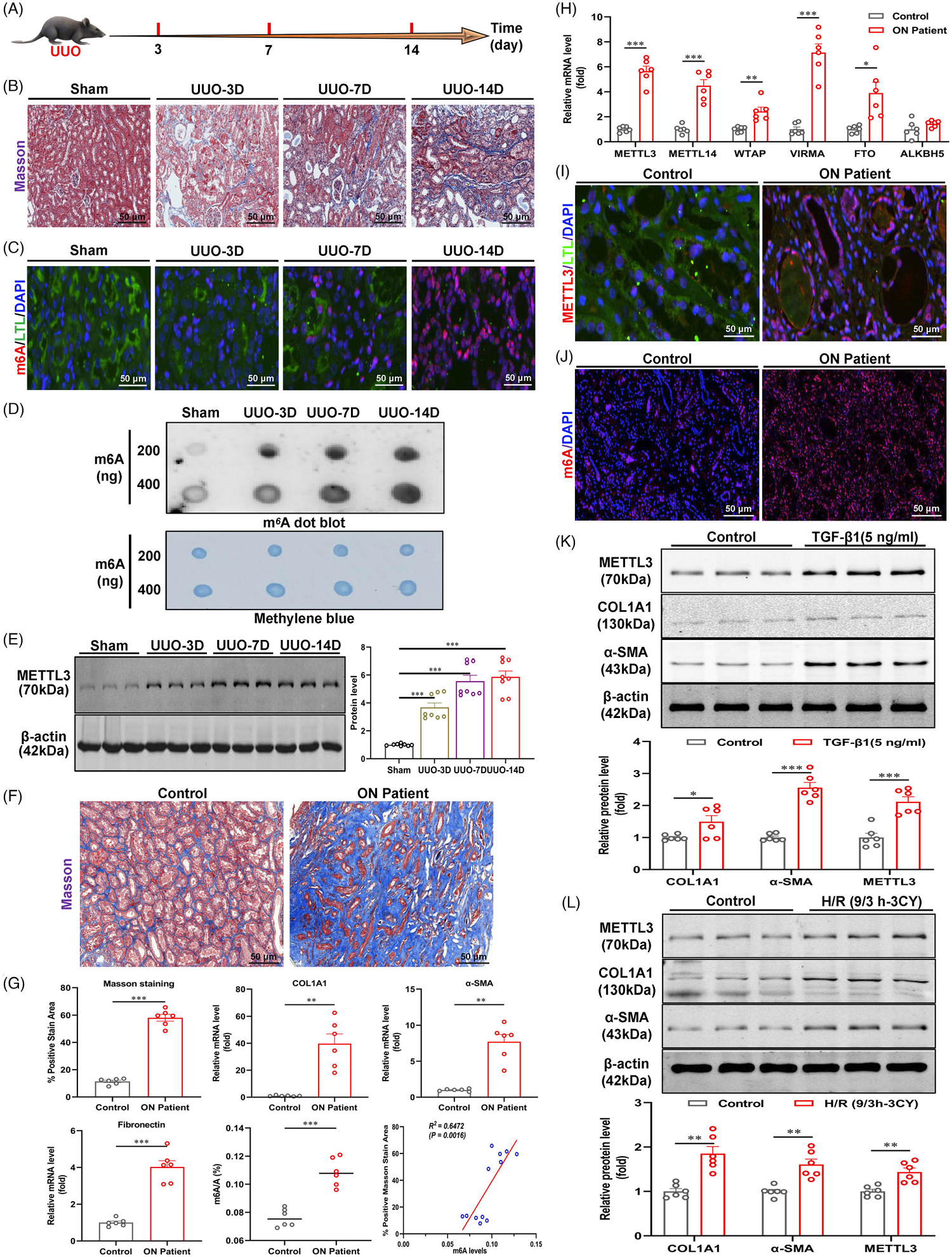 基因和药物抑制METTL3减少肾纤维化的表观遗传多组学机制研究