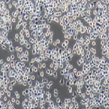 RIN-M5F 大鼠β胰岛素瘤细胞