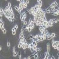 U14 小鼠子宫颈癌细胞