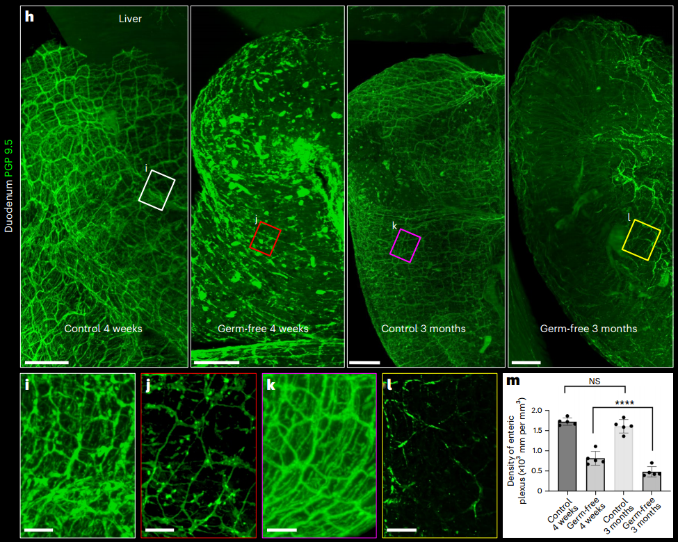 Nature Biotechnology（IF=46.9）：组织透明化技术新突破——小鼠全身免疫荧光标记结合组织透明化技术获得完整小鼠三维整体结构
