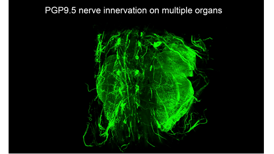 Nature Biotechnology（IF=46.9）：组织透明化技术新突破——小鼠全身免疫荧光标记结合组织透明化技术获得完整小鼠三维整体结构