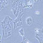 GT1-1 小鼠垂体瘤细胞