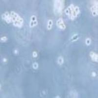 Walker/LLC-WRC 256 大鼠腹水癌细胞