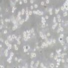 SDOW-17 小鼠杂交瘤细胞