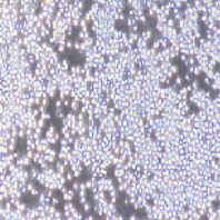 Sp2/O-Ag14 小鼠骨髓瘤细胞