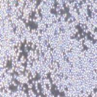 Sp2/O-Ag14 小鼠骨髓瘤细胞