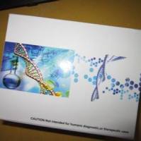 小鼠基质金属蛋白酶13(MMP-13)elisa试剂盒免费代测