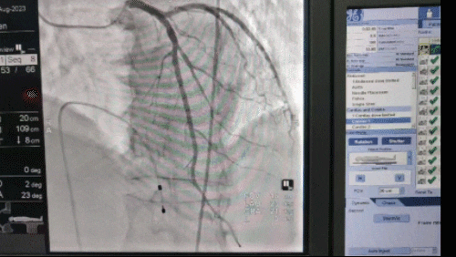 「救」在生死边缘，我院胸痛中心团队再次斩断死神魔爪