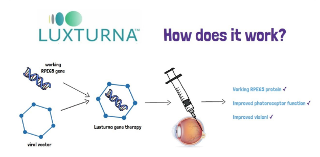 行业资讯丨242万元单价的眼科AAV基因治疗药在日本纳入医保