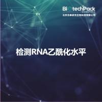 检测RNA乙酰化水平