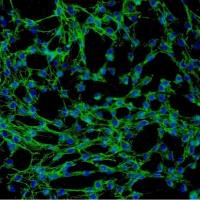 人胸腺成纤维细胞