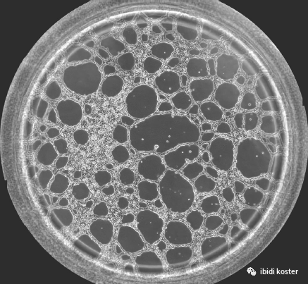 血管生成实验| 可节省基质胶和成像清晰的实验方法你会了吗