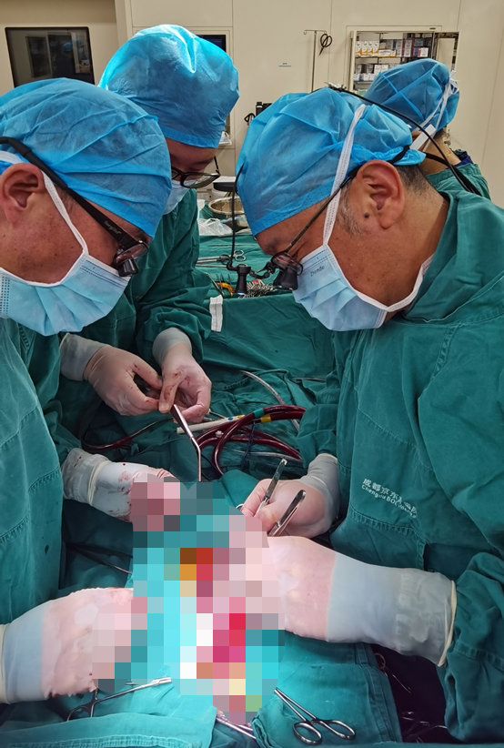 成都北京专家携手「补心」 ，成功挽救「无脉女孩」