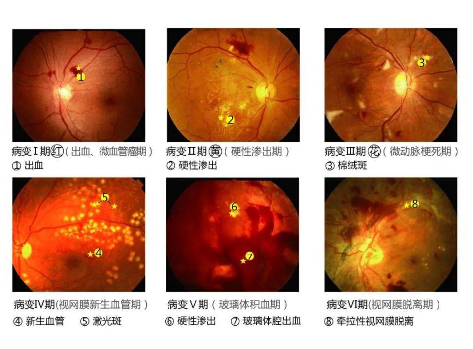 武汉普瑞眼科医院提醒:这些人群需要定期进行眼健康检查