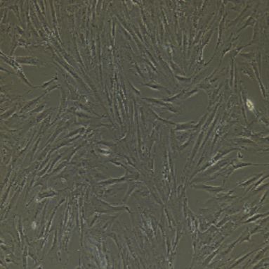 真皮成纤维细胞/小鼠肝窦内皮细胞主动脉平滑肌细胞/