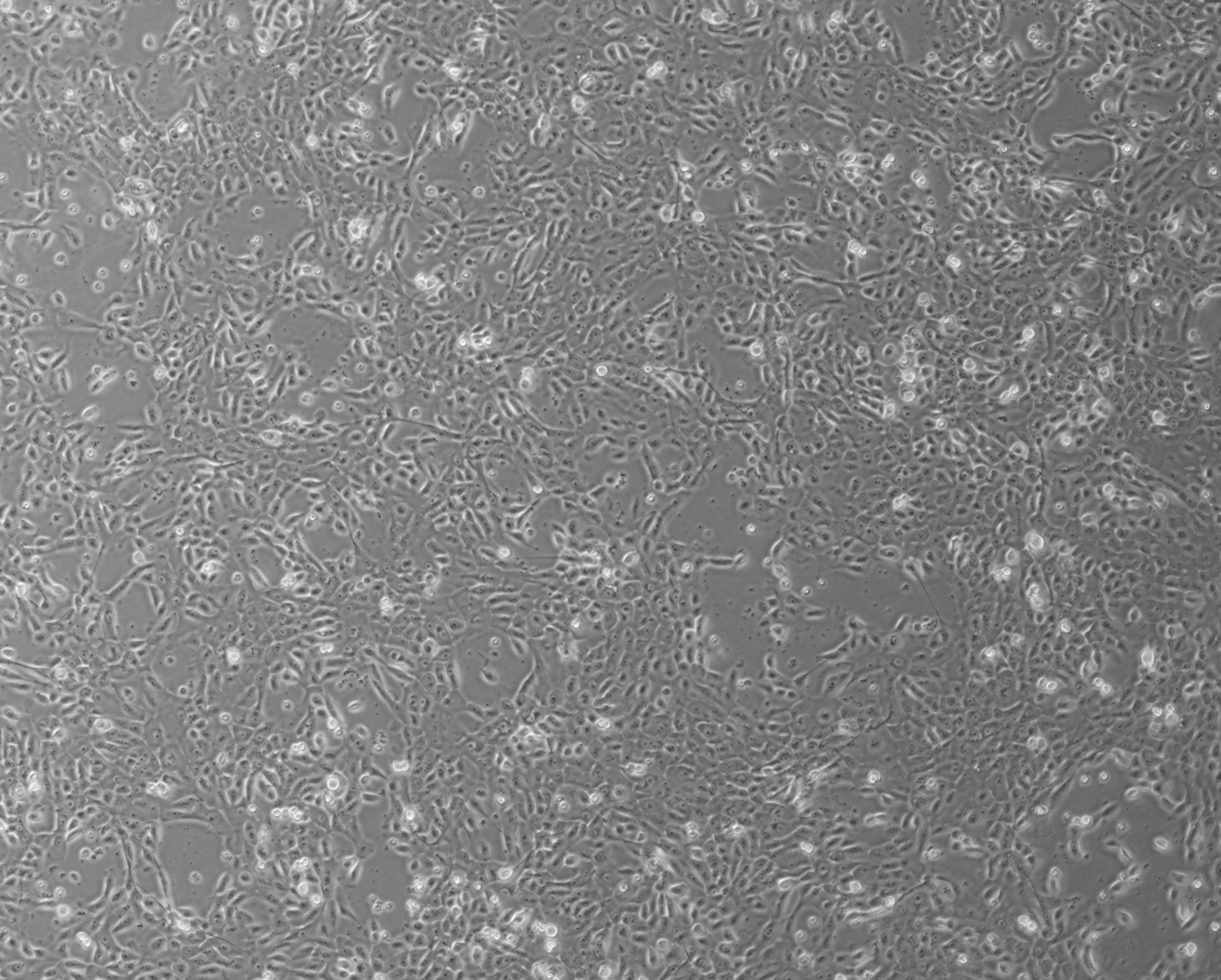 ​细胞攻略 | MCF 10A(人正常乳腺上皮细胞)