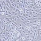 大鼠肾成纤微细胞_NRK-49F