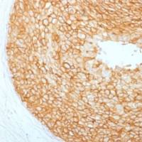 HER2 Monoclonal Antibody单抗