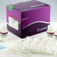 磁珠法质粒试剂盒