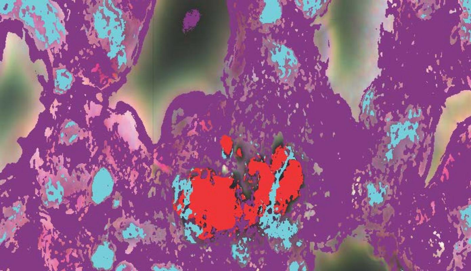 HORIBA | 用户访谈 | 是否应该担心纳米毒性问题？
