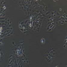 人肺癌细胞（淋巴结转移）_NCI-H292