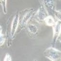 人肺腺癌细胞；NCI-H1975