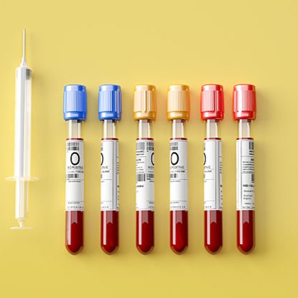 IVD临床试验代理 临床试验外包（CRO）