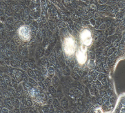 Calu-3人肺腺癌细胞