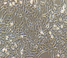 CTX 大鼠脑星形胶质细胞