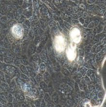 Calu-3人肺腺癌细胞