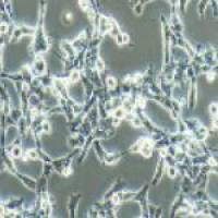 人高转移肺癌细胞（STR鉴定）