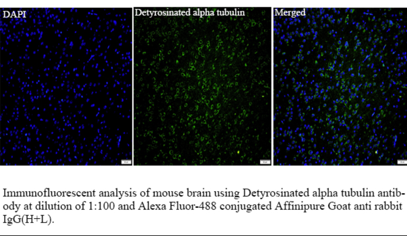 鼠单克隆抗体制备