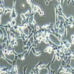 95-D人高转移肺癌细胞