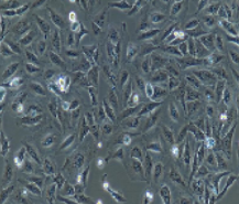 nci-h446人小细胞肺癌细胞