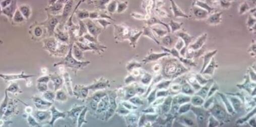 细胞常见的污染源及规避急救方法