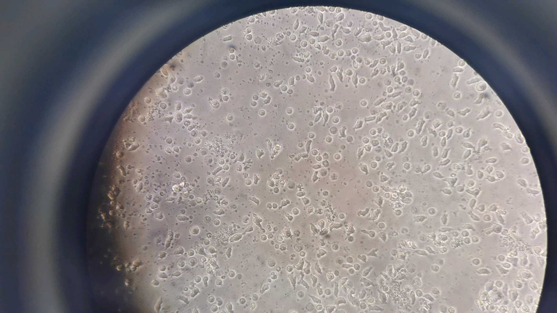 黑胶虫污染 - 细胞生物与生物信息 - 医学交流社区,分享临床经验,病例