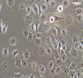 NCI-H661人大细胞肺癌细胞