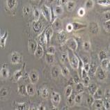 NCI-H661人大细胞肺癌细胞