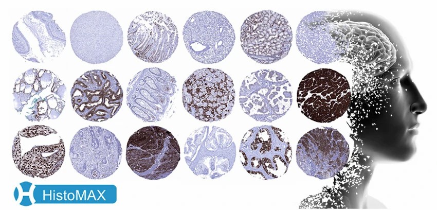 HistoMAX – IHC-validated Antibodies