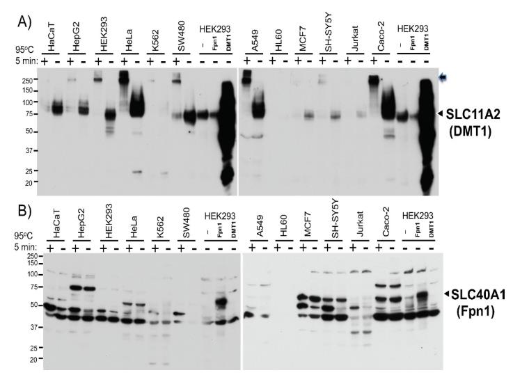 膜蛋白WB制样能不能煮沸？