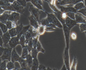 人未分化胃癌细胞_HGC-27