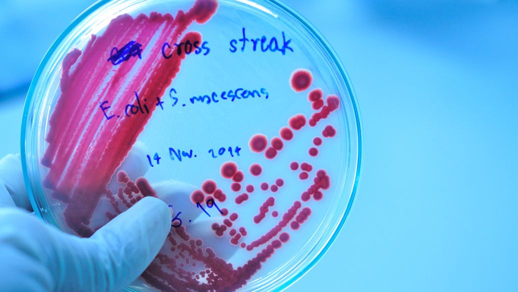 【会议笔记分享】菌落总数测定过程需要特别注意点的解析